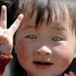 Мальчик с кошачьими глазами может видеть в темноте. (ФОТО) Мальчик с кошачьими глазами может видеть в темноте. (ФОТО)