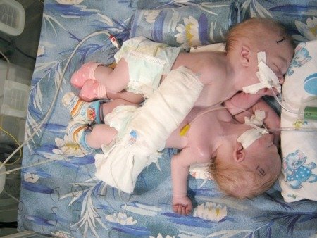 Акушерки были в шоке,когда увидели кого родила эта женщина! (ФОТО) Акушерки были в шоке,когда увидели кого родила эта женщина! (ФОТО)